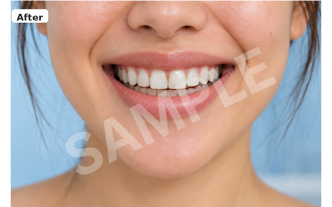 Sample after image
