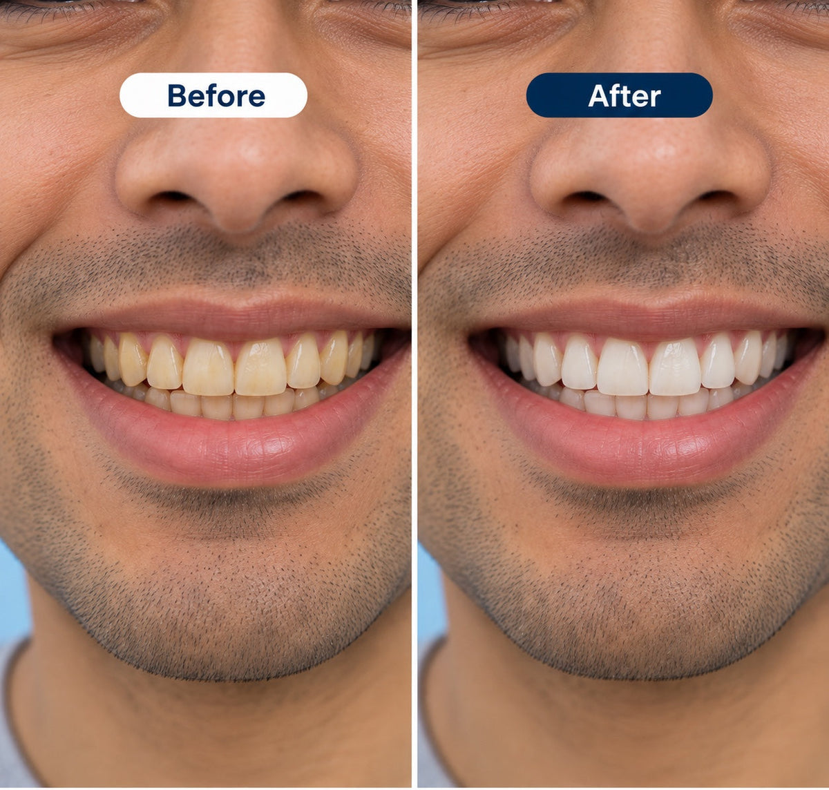 AI-generated before and after illustration, not a real customer result