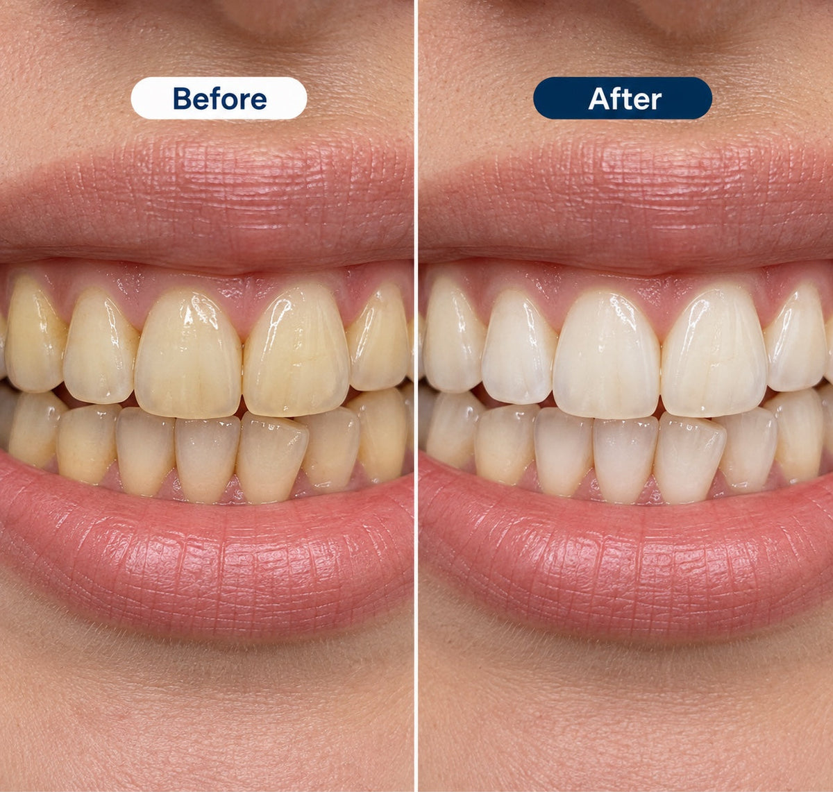 AI-generated before and after illustration, not a real customer result