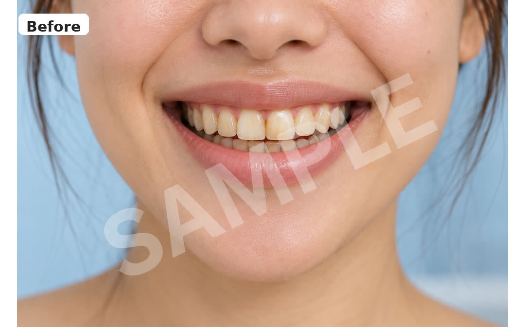 Sample before image